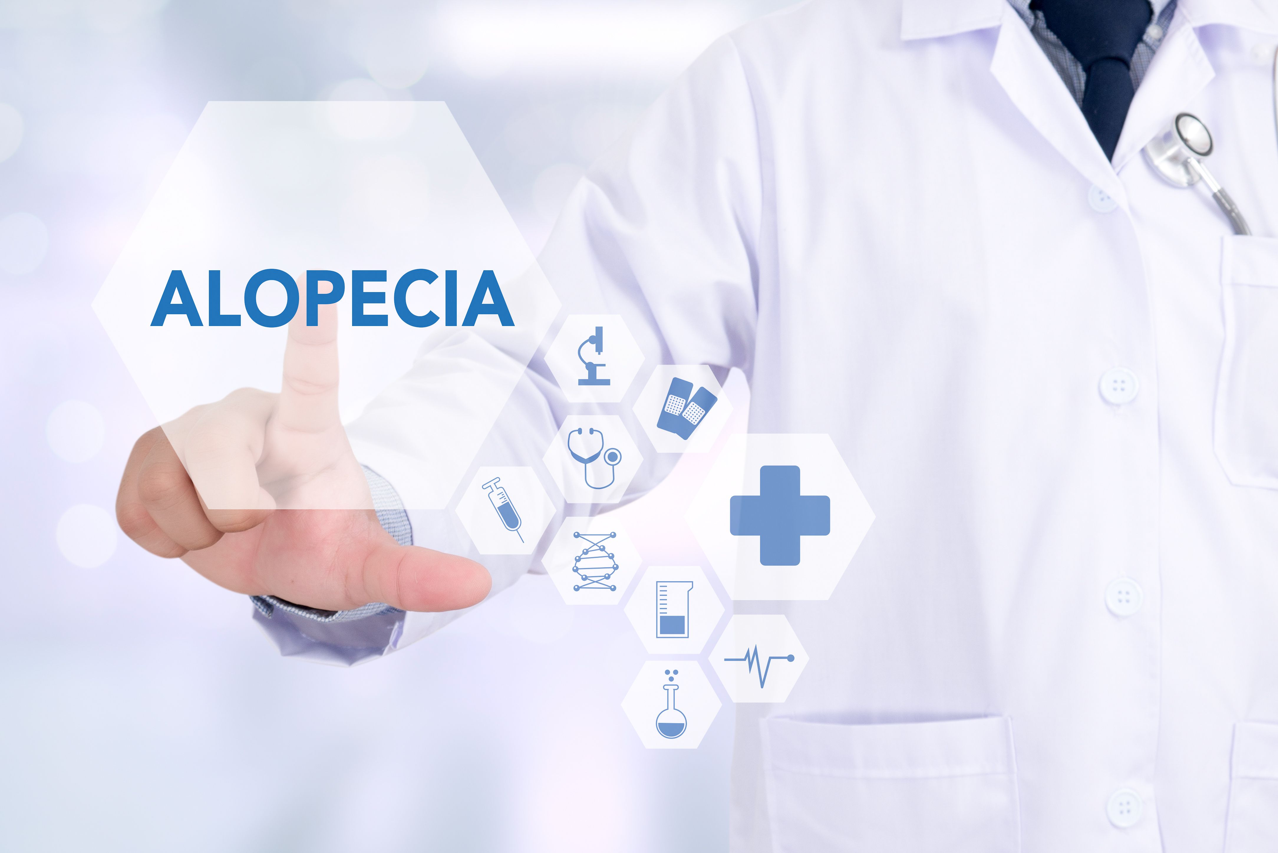 Alopecia | Image Credit:  onephoto - stock.adobe.com