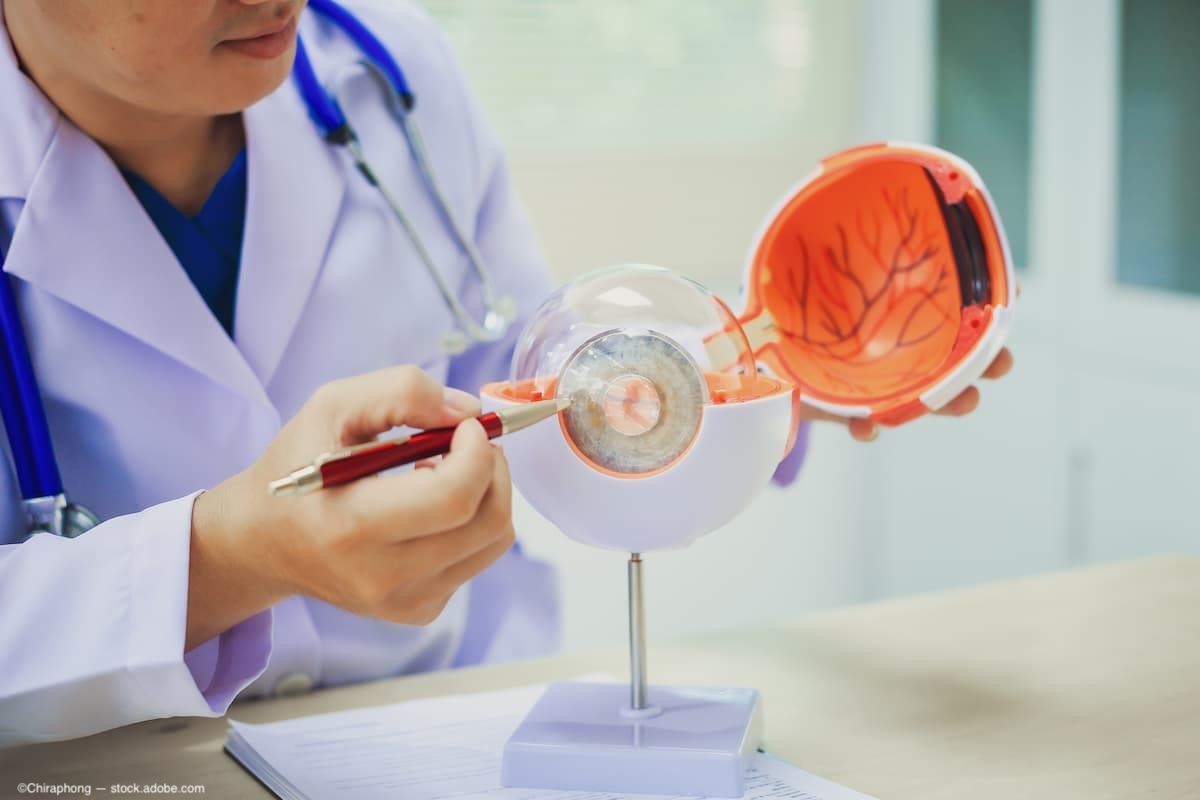 Cabozantinib linked to corneal perforation in patient with renal cell carcinoma